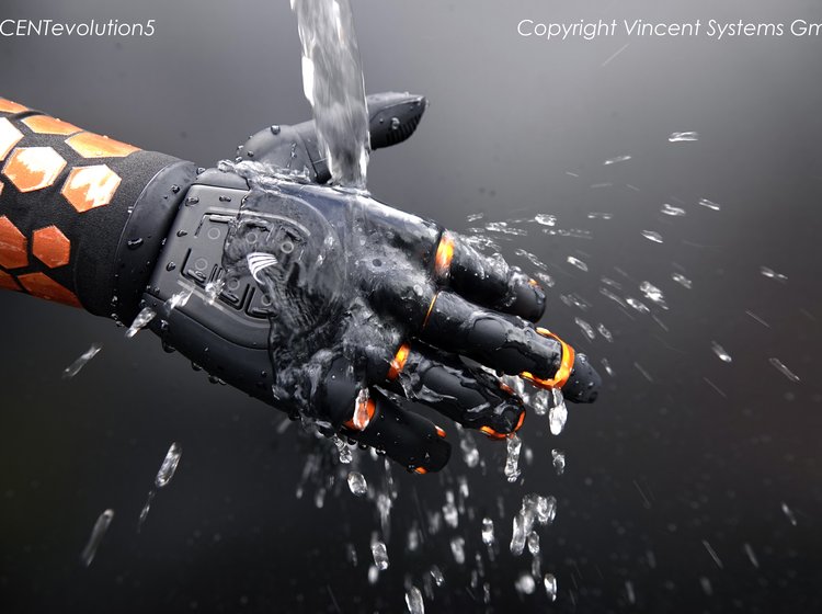 Eine individualisierbare Handprothese in vielen verschiedenen Farbmöglichkeiten von VINCENT-Systems